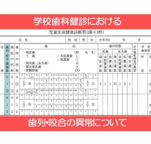 学校歯科健診における歯列・咬合の異常について