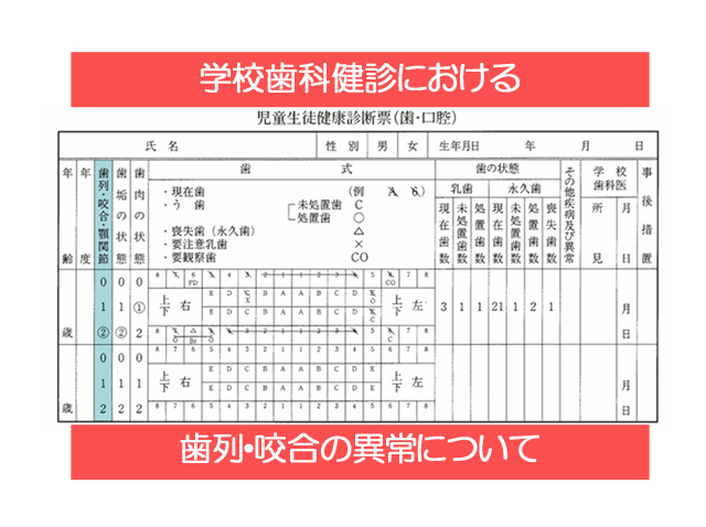 学校歯科健診における歯列・咬合の異常について